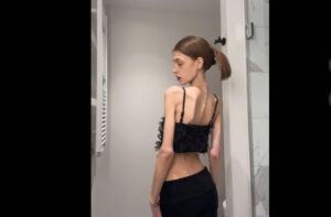 Skinnytok: η διαδικτυακή πρόκληση που απειλεί τους νέους – Ερώτηση του Τσιόδρα στην Κομισιόν