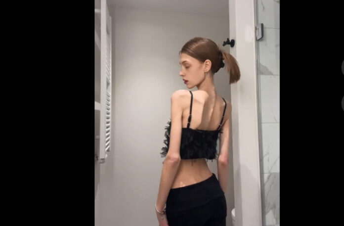 Skinnytok: η διαδικτυακή πρόκληση που απειλεί τους νέους – Ερώτηση του Τσιόδρα στην Κομισιόν