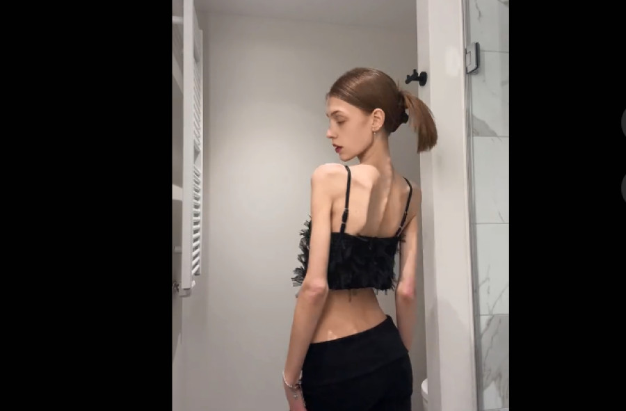 Skinnytok: η διαδικτυακή πρόκληση που απειλεί τους νέους – Ερώτηση του Τσιόδρα στην Κομισιόν