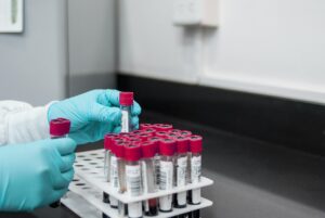 COMBINE PILOT: Η πρωτοβουλία της ΕΕ για λιγότερη γραφειοκρατία στις συνδυαστικές κλινικές μελέτες