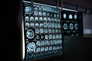 EUROMEDICA: Πρωτοβάθμια φροντίδα υγείας με 21 σύγχρονα διαγνωστικά κέντρα σε πέντε πόλεις