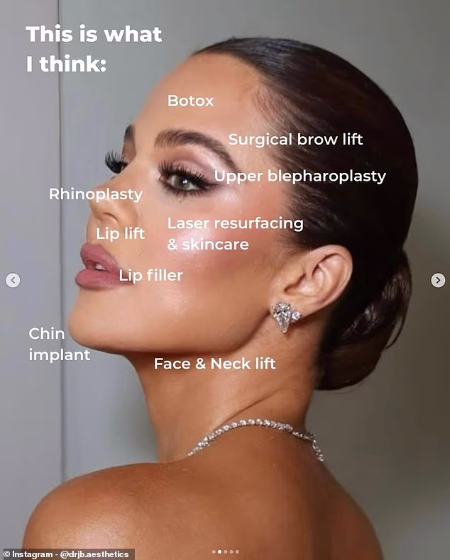 Khloe Kardashian: Πλαστικός χειρουργός εκτιμά ποιες επεμβάσεις έχει κάνει – Τι έχει αλλάξει στο πρόσωπό της