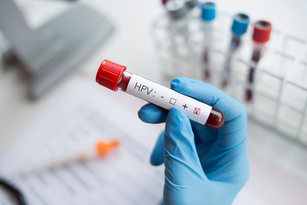 HPV: Τι γνωρίζουμε για τον ιό που είναι πολύ συχνός αλλά παραμένει παρεξηγημένος