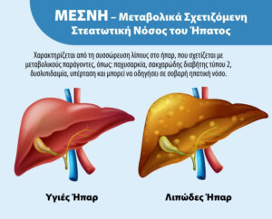 UNI-PHARMA: Ευρωπαϊκή διάκριση για το καινοτόμο συμπλήρωμα Hepatrat κατά του λιπώδους ήπατος